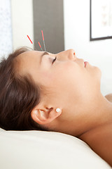 Image showing Facial Acupuncture