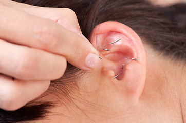 Image showing Ear Acupuncture Detail