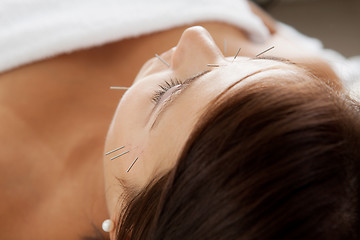 Image showing Facial Acupuncture Beauty Treatment