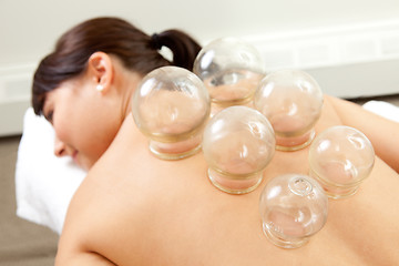 Image showing Detail of Woman with Acupuncture Cupping Treatment