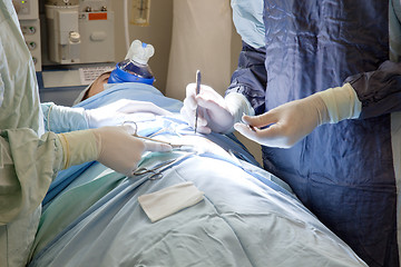 Image showing Patient going through an operation
