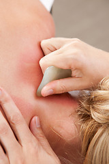 Image showing Gua Sha Acupressure Treatment