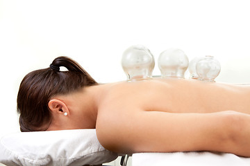 Image showing Cupping Treatment Detail