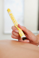 Image showing Moxibustion Acupuncture Technique