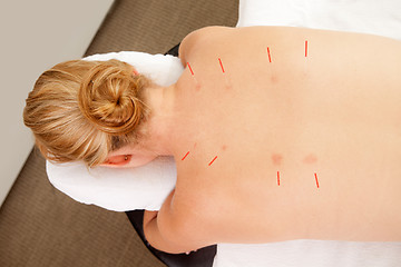 Image showing Back Shu Acupuncture Points