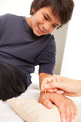 Image showing Shonishin Acupuncture with Yoneyama Tool