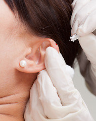 Image showing Auricular Acupuncture Detail