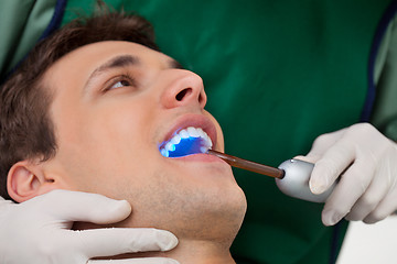 Image showing Dentist with UV Light