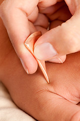 Image showing Macro Detail of Yoneyama Acupuncture Tool