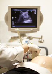 Image showing medical examining by ultrasonic scan