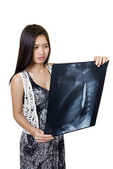 Image showing beautiful woman holding an x-ray