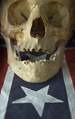 Image showing skull detail