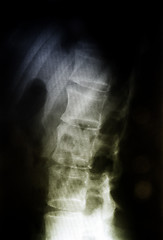 Image showing X-ray