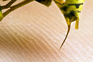 Image showing wasp stinging a human