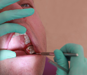 Image showing Dental abstract