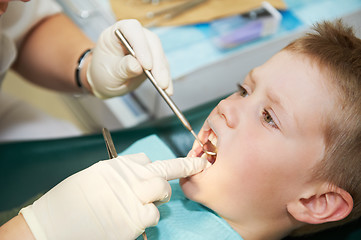 Image showing dental examination of child