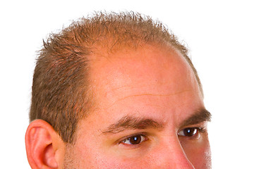 Image showing Young man with hair problem