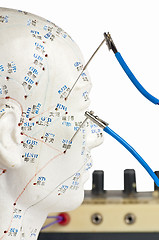 Image showing electro-acupuncture