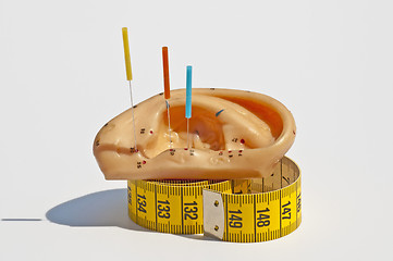 Image showing acupuncture for weight loss