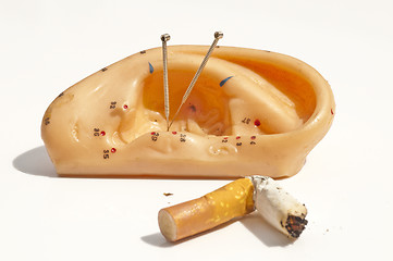 Image showing acupuncture to stop smoking