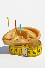 Image showing acupuncture for weight loss