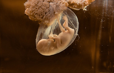 Image showing human embryo