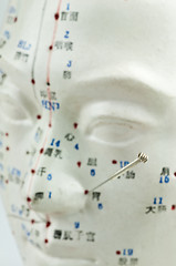 Image showing Acupuncture needles on head model