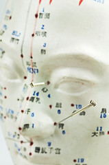Image showing Acupuncture needles on head model