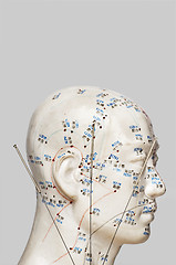 Image showing Acupuncture needles