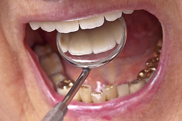 Image showing teeth examination