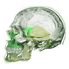 Image showing skull