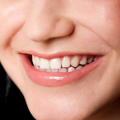 Image showing Beautiful teeth in a perfect smile