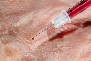 Image showing Injection into hand of senior male