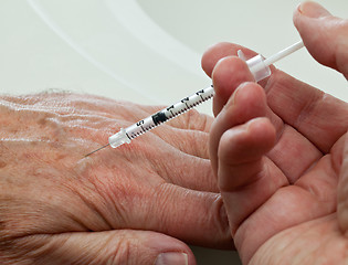 Image showing Injection into hand of senior male