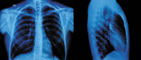Image showing X-Ray 