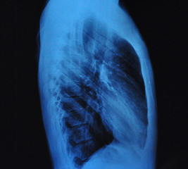 Image showing X-Ray