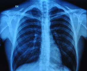 Image showing X-Ray