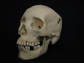 Image showing Human cranium