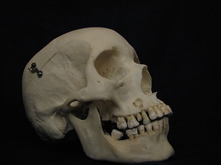 Image showing Cranium, side view