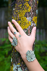 Image showing lichen on the hand