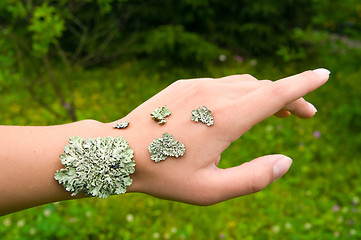 Image showing lichen on the hand