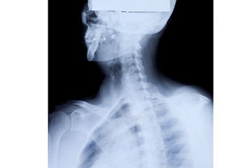 Image showing Upper Body X-ray