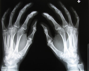 Image showing X-Ray hands