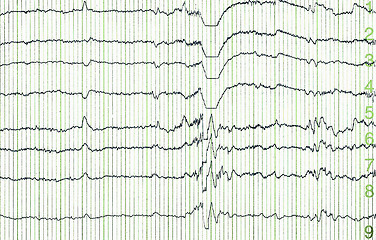 Image showing electro-encephalogramme