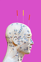 Image showing Acupuncture needles on head model