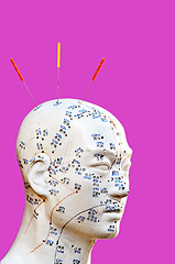 Image showing Acupuncture needles on head model