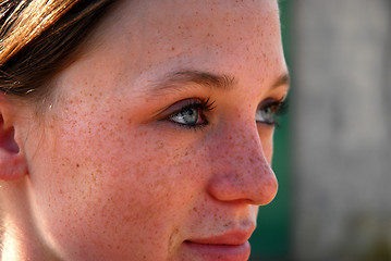 Image showing freckles