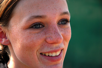 Image showing freckles