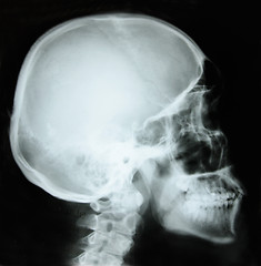 Image showing photo of side x-ray picture of human skull in natural colors