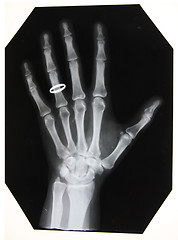 Image showing black and white photo of x-ray picture of woman hand with the ring